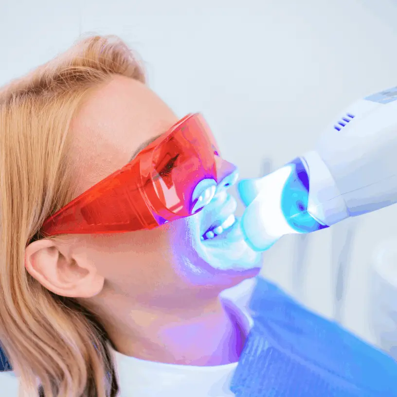 Blanqueamento dientes