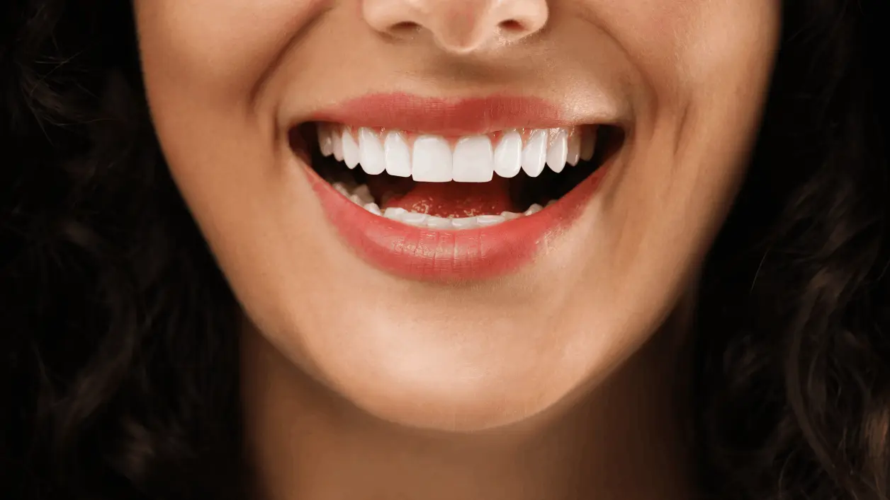 Carilla Dental Composite