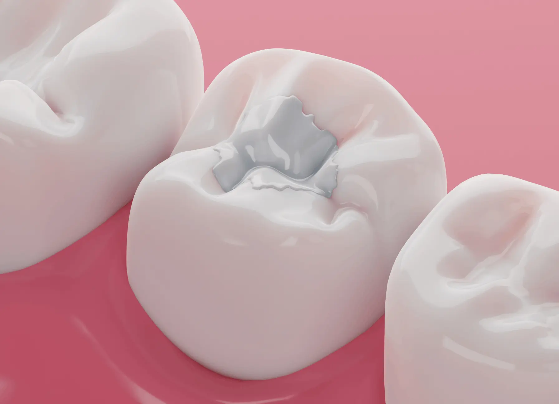 reconstrucción dental