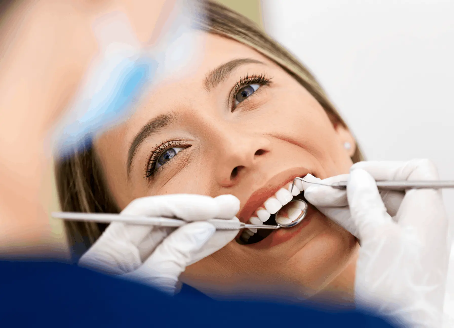 reconstrucción dental